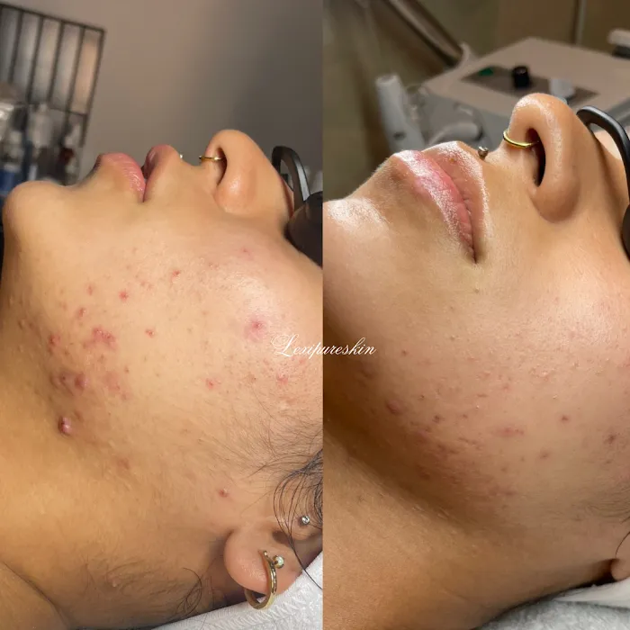 Lexipureskin Aesthetics Picture 3