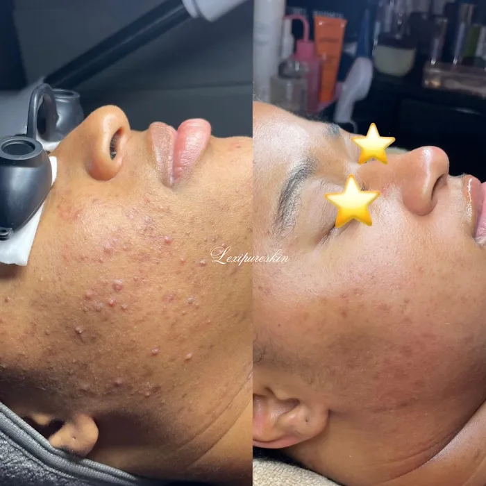 Lexipureskin Aesthetics Picture 4