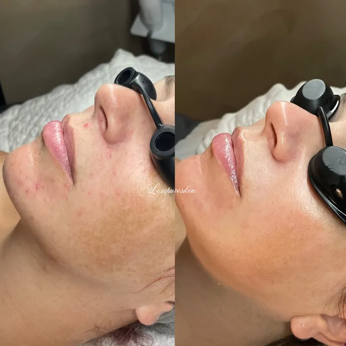 Lexipureskin Aesthetics Picture 5