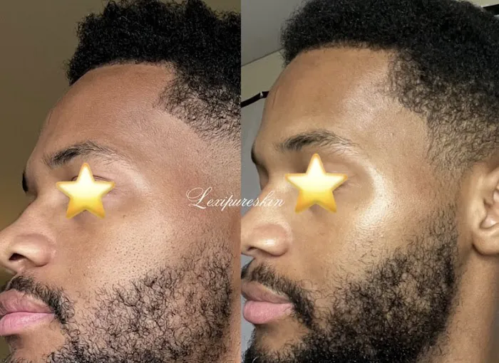 Lexipureskin Aesthetics Picture 6