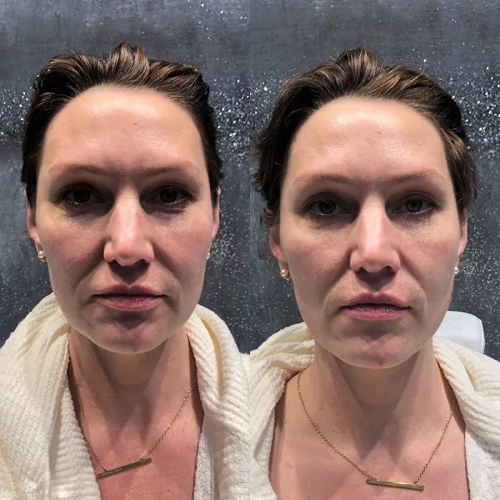 Atlanta Medical Aesthetics Picture 6