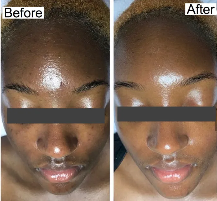 Flesh Skin Studio Picture 5