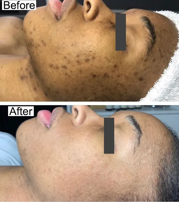 Flesh Skin Studio Picture 6