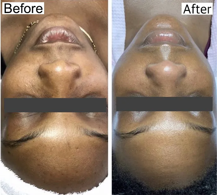 Flesh Skin Studio Picture 9