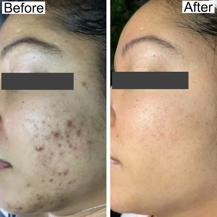 Flesh Skin Studio Picture 8