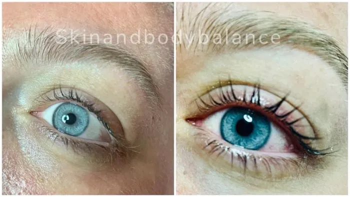 Skin and Body Balance Picture 5