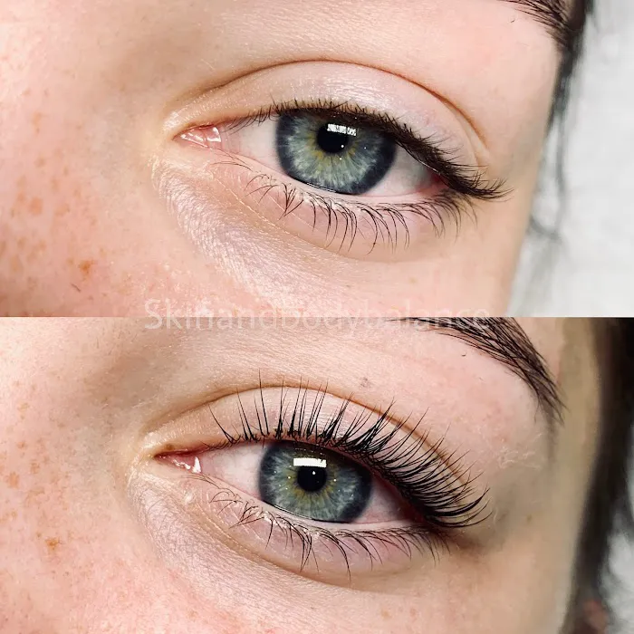 Skin and Body Balance Picture 3