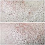 Skin and Body Balance