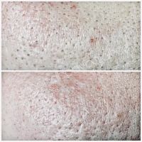 Skin and Body Balance ico