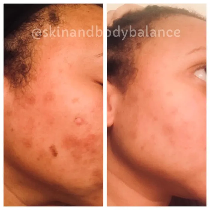 Skin and Body Balance Picture 9