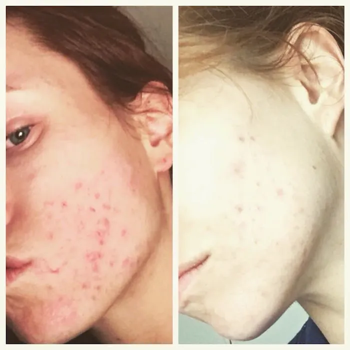 Skin and Body Balance Picture 7