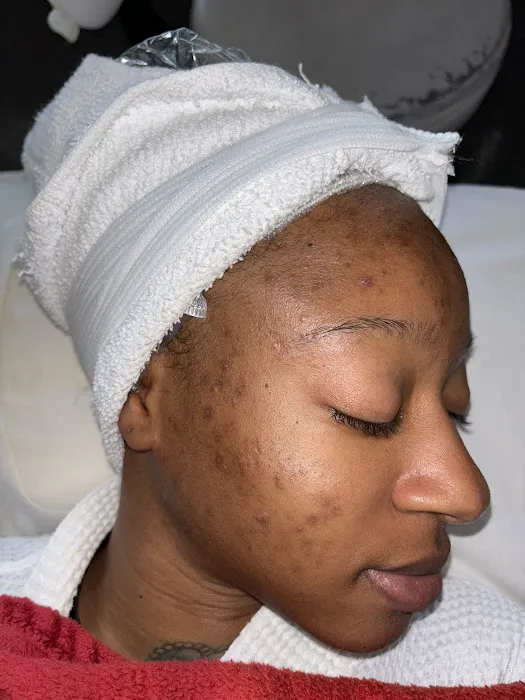 Entoria Skin Care Picture 1