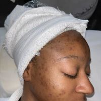 Entoria Skin Care ico