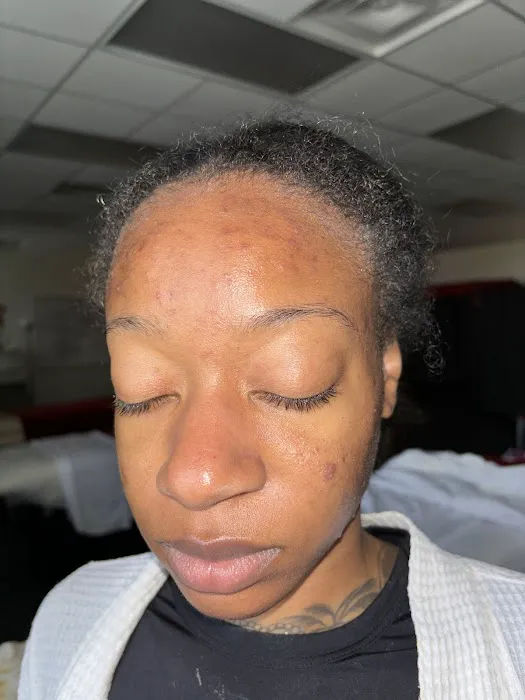 Entoria Skin Care Picture 5