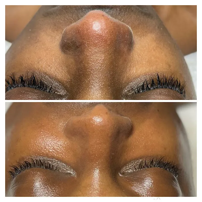 pHace It Skin Care Bar Picture 6