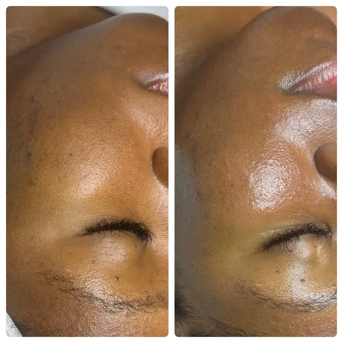 pHace It Skin Care Bar Picture 4