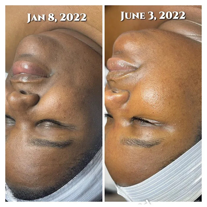 pHace It Skin Care Bar Picture 5