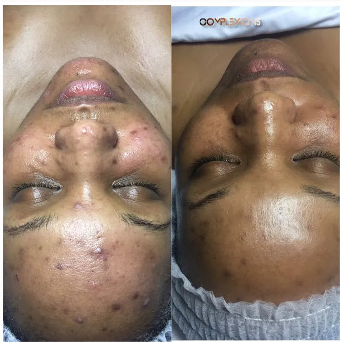 Complexions Skincare & Beauty Picture 5