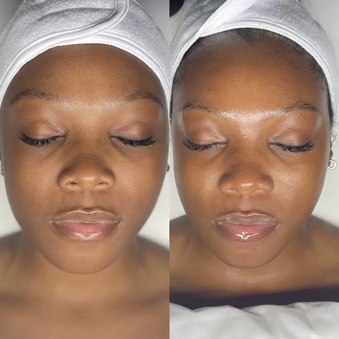 Skin by Callie Picture 8