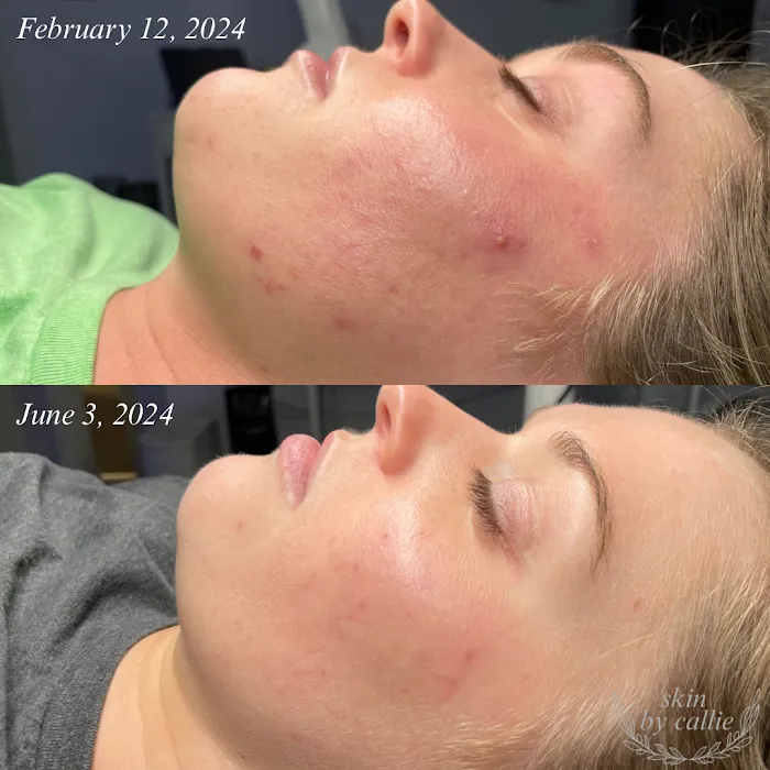 Skin by Callie Picture 6