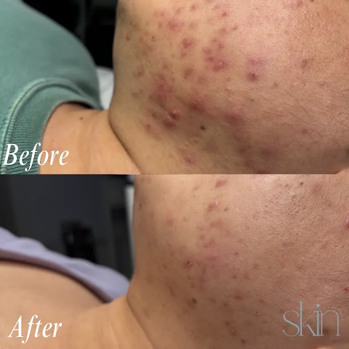 Skin by Callie Picture 7