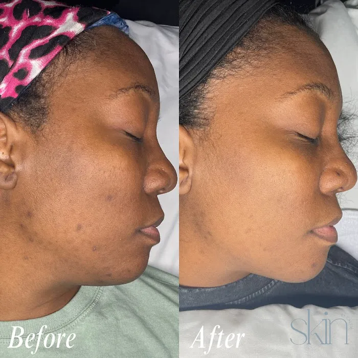 Skin by Callie Picture 9