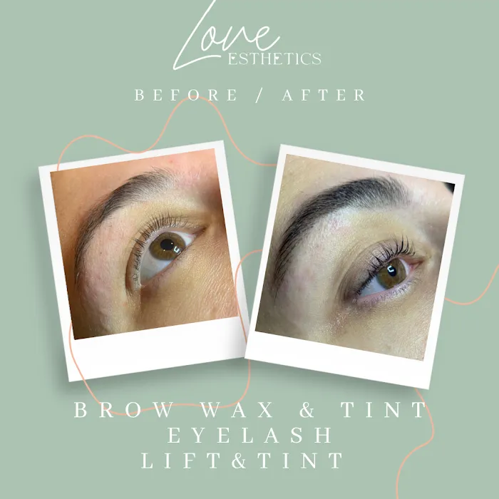 Love Esthetics Picture 9