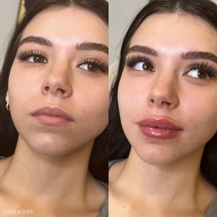 Ecobel Med Spa Picture 4