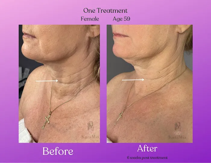 KaraMia by Tanya Picture 6