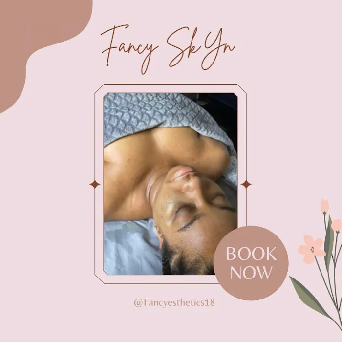 Fancy SkYn Picture 4