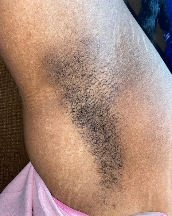 Fancy SkYn Picture 6