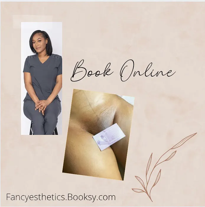 Fancy SkYn Picture 5