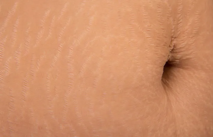 Skyn Deep Studio Picture 6