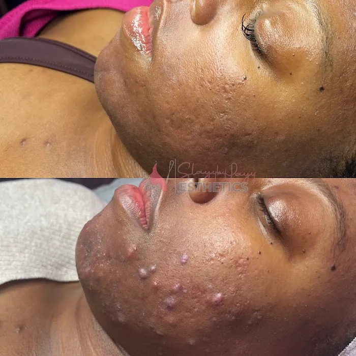 Slayy By Layy Esthetics, LLC Picture 3