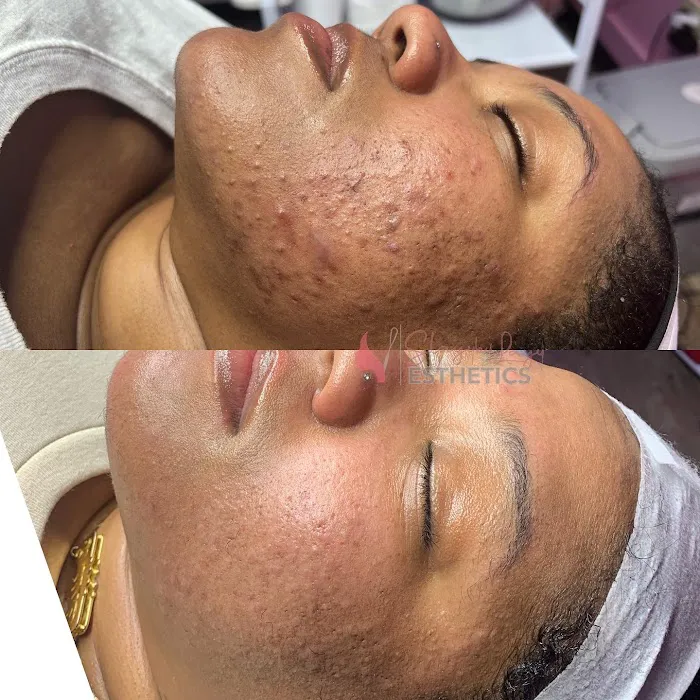 Slayy By Layy Esthetics, LLC Picture 2