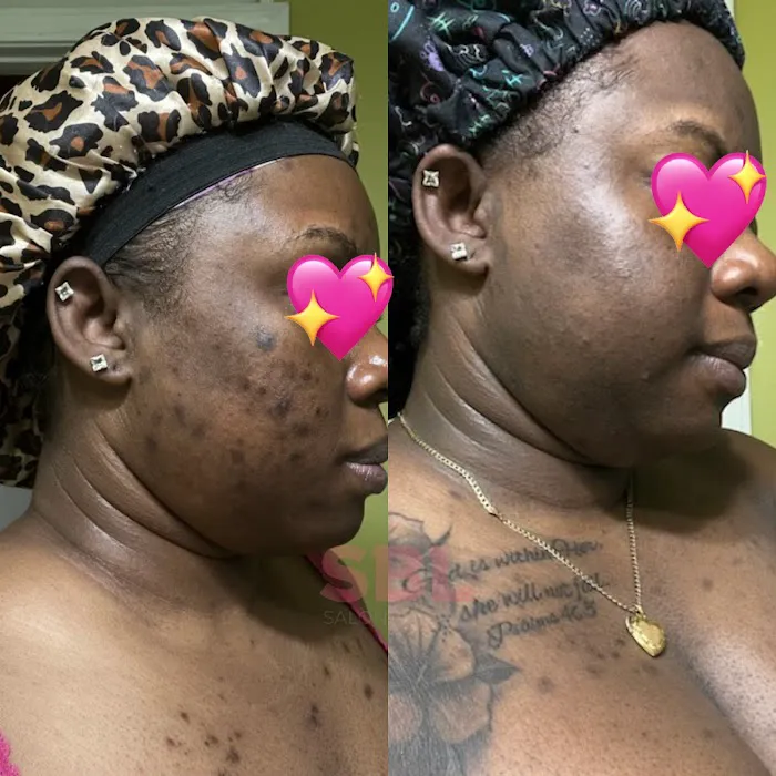 Slayy By Layy Esthetics, LLC Picture 6