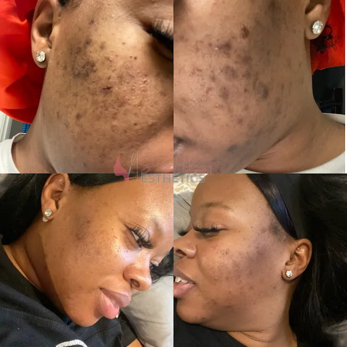 Slayy By Layy Esthetics, LLC Picture 5