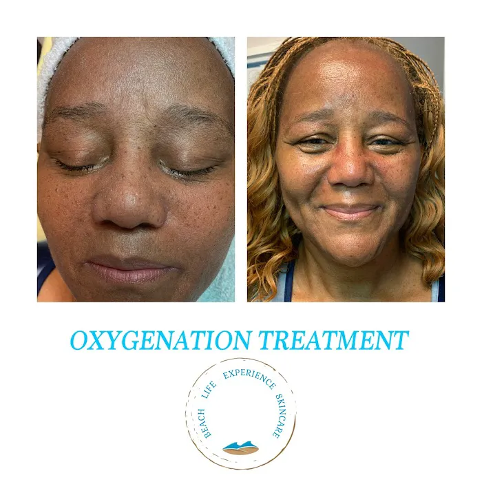 Beach Life Experience Skin Clinic Picture 7