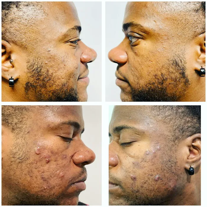 Beach Life Experience Skin Clinic Picture 6