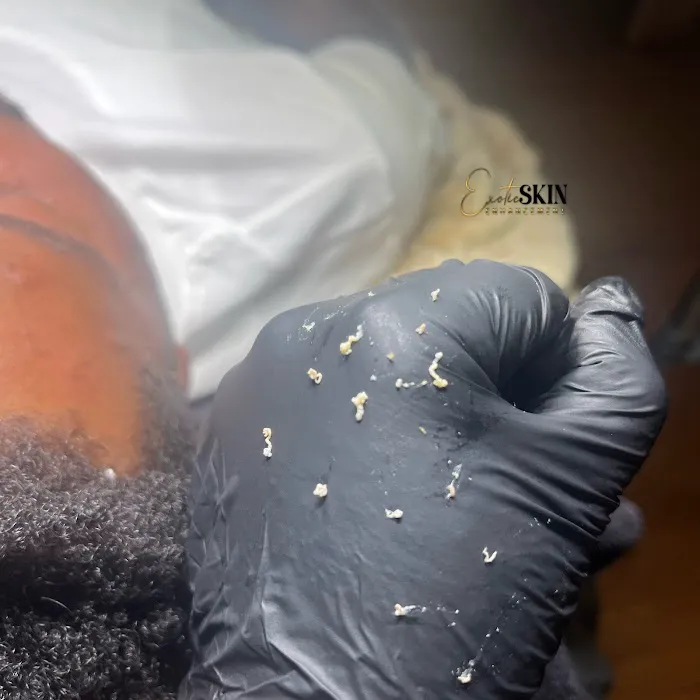 Exotic Skin Enhancement Picture 2