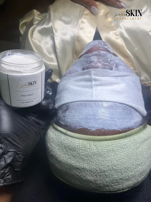 Exotic Skin Enhancement Picture 6