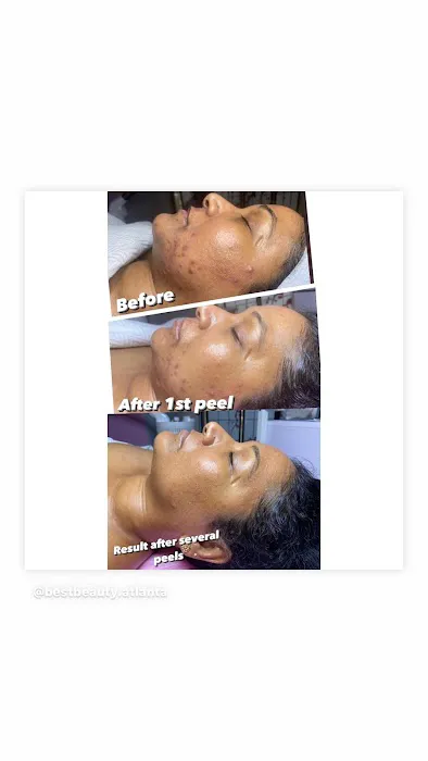 Best Beauty Spa Picture 1