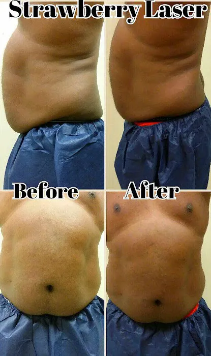 Laser Body Works Picture 2