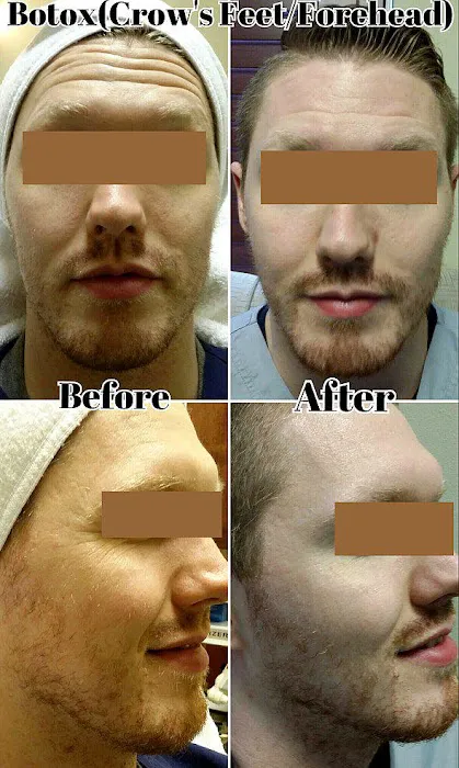 Laser Body Works Picture 1