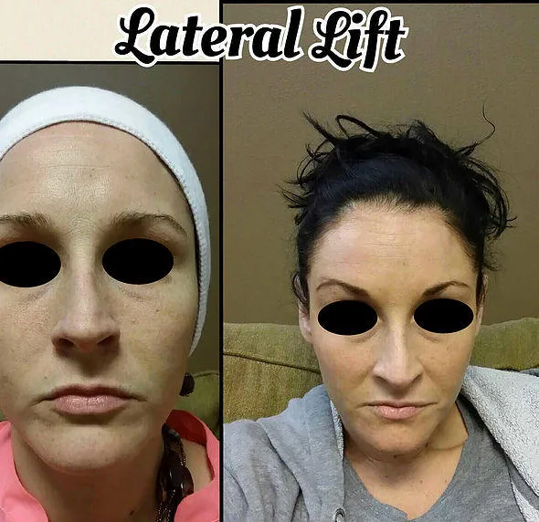 Laser Body Works Picture 4