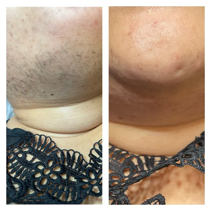 Exquisite Electrolysis Picture 9