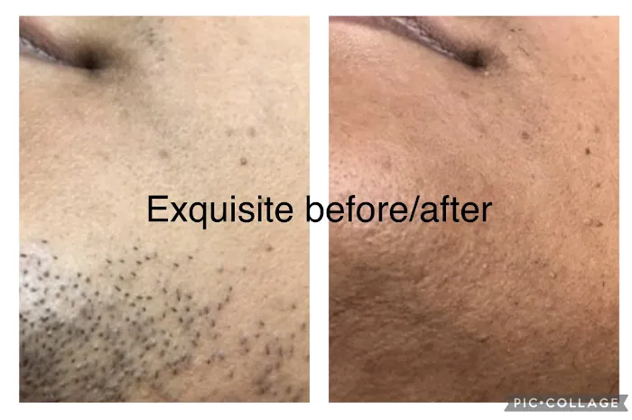 Exquisite Electrolysis Picture 10