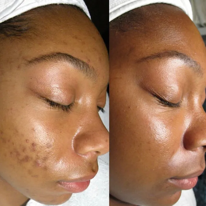 Crystal Ngozi Beauty & Esthetics Picture 9
