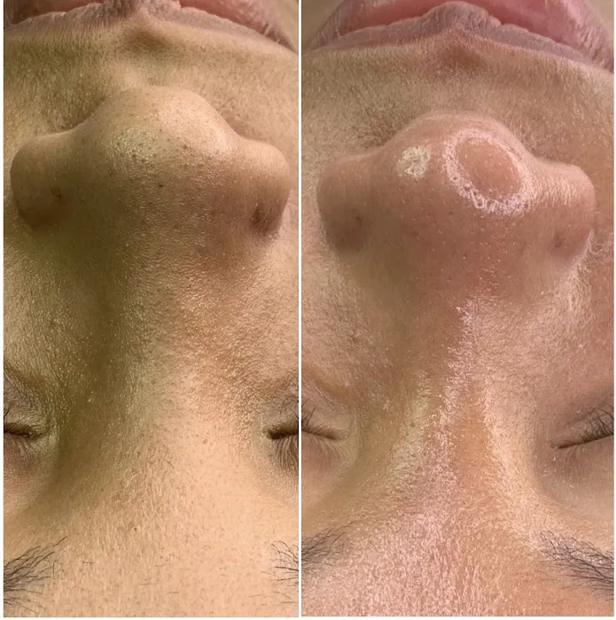 Beauty Therapy by Chanel Picture 2