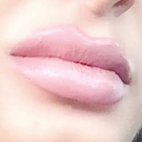 Advanced Aesthetics Artistry Picture 4